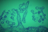 4 minuti faDov’erano gli hantavirus prima che li scoprisse tutto il mondoDa un fiume coreano fino alla casa di Gene Hackman, la storia di come li abbiamo scoperti, studiati e ci abbiamo avuto a che fare è sempre rimasta ai margini del dibattito