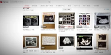 2 minuti faIl principale e-commerce giapponese ha vietato la vendita di ecografie di fetiIl sospetto è che venissero usate per compiere truffe