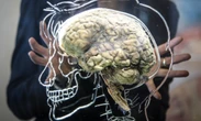 3 minuti faC’è un primo trattamento promettente contro la malattia di HuntingtonUna delle malattie genetiche neurodegenerative più difficili e finora senza cura