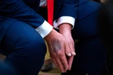1 minuto faPerché preferiamo una mano all’altra?Un nuovo studio ipotizza che la posizione eretta e lo sviluppo del nostro cervello ebbero un ruolo determinante, ma mancano ancora molti pezzi