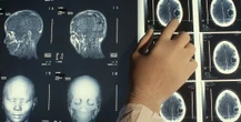 1 minuto faQuanto fidarsi delle AI per la nostra saluteSaranno sempre più usate per fare diagnosi e prescrivere terapie, ma che succede se si inventano malattie o parti anatomiche?