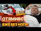 ТЕРМІНОВІ НОВИНИ: "Спробував гальмувати, А НОГИ НЕМАЄ" Медики ледь ВИЖИЛИ після атаки дрона РФ!