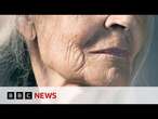 New skin research could help slow signs of ageing | BBC News