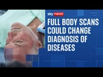 100,000 bodies scanned to help change the way diseases are diagnosed