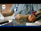 Post-pandemic cardiac deaths continue to rise