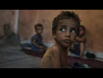 Gaza : la faim tue les plus jeunes, l’ONU tire la sonnette d’alarme