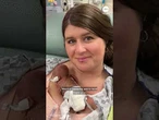 ‘World’s most premature baby’ celebrates 1st birthday