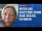 Unlicensed Botox-like injections spark outbreak of rare, life-threatening disease