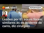 Mulher que levou 61 socos do namorado teve lesões semelhantes às de acidente de carro, diz cirurgião