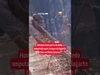 Homem tem parte do dedo amputada após ataque de lagarto teiú em Mato Grosso