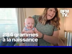 Le plus grand prématuré du monde, né à 21 semaines, a fêté son premier anniversaire