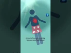 Das kann passieren, wenn Du an heißen Tagen in zu kaltes Wasser springst