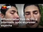 Influenciador Ken de CG conta que foi internado após espremer espinha na boca