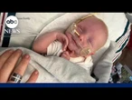 Doctors saved baby's life with gene fix for deadly rare disease