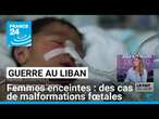 Guerre au Liban : des cas de malformations fœtales chez des femmes enceintes • FRANCE 24