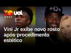 Vini Jr. exibe novo rosto após fazer 'naturalização facial' com o mesmo médico de Virginia Fonseca