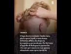 L’Inps deve ridare 5000 euro a una 70enne: parrucche e cure sono spese mediche, non un reddito
