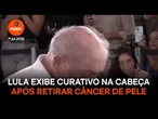 Lula exibe curativo na cabeça após retirar câncer de pele