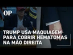 Mão maquiada de Trump levanta novas suspeitas sobre saúde