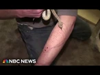 Man who let deadly snakes bite him 200+ times could be key to new antivenom