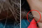 Frau isst Suppe und hat plötzlich starke Schmerzen: Wochen später kommt die Wahrheit ans Licht