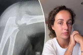 Schlimme Diagnose für Samiras Sohn: "Wir haben dem Arzt vertraut"