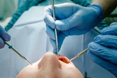 Polizeieinsatz nach Zahnarzt-Besuch! Patientin dreht bei Behandlung völlig durch
