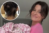 Plötzlicher Haarverlust bei Marlene Lufen: "Es hat mich richtig fertig gemacht"