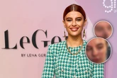 Ohne Filter und Schminke: GNTM-Model zeigt sich ungeschönt auf Social Media
