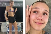 Influencerin nach Klinik-Schock in Tränen: "Der Arzt hat mich so verarscht"