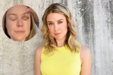 Was war da denn los? GZSZ-Star Nina Ensmann klärt Fans über ihr fettes Veilchen auf