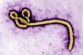 Ebola-Alarm in Tschechien: Mann nach Afrika-Reise isoliert