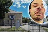 Kommt der Täter aus dem Drogenmilieu? Partygast vor Dresdner Club niedergeschlagen