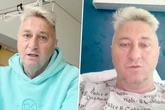 Nächste Schreckens-Nachricht für Hubert Fella: "Dschungelcamp"-Liebling muss unters Messer