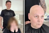 Frau hat wegen Krebs keine Haare mehr: Wie sie nach Umstyling aussieht, raubt ihr den Atem