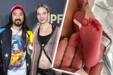 Am eigenen Hochzeitstag: Star-DJ zum ersten Mal Vater geworden