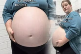 Frau hat in der 25. Schwangerschaftswoche XXL-Bauch: Der Grund lässt alle nach Luft schnappen