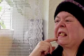 Pamela trägt Zahnprothese nicht, "weil die mir ins Zahnfleisch tun"