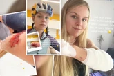 Böser Rad-Unfall im Training: Biathlon-Ass gewährt blutige Eindrücke