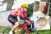 Hirnblutung nach Sturz bei Klassiker: Jetzt zeigt Radsport-Talent seine krassen Wunden