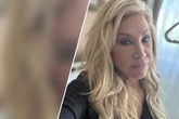 Horror-Sturz in den eigenen vier Wänden: Carmen Geiss muss am Gehirn operiert werden