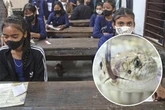 Schlange im Suppentopf: Totes Tier in Schulessen vergiftet Hunderte Kinder