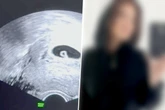 Schicksalsschlag für Reality-Star: "Beauty & The Nerd"-Bekanntheit verliert ihr Baby