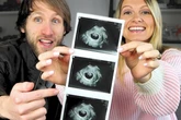 Abtreibung nach Down-Syndrom-Diagnose: YouTuber-Paar erhält Todesdrohungen