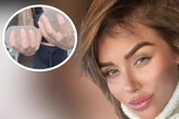 Kim Gloss lässt sich zum dritten Mal Brüste operieren: Doch es gibt Komplikationen