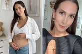 Krankenhaus! Schock für schwangere Clea-Lacy Juhn