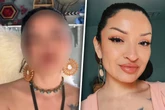 Frau erfüllt sich mit Nasen-OP Lebenstraum: Als sie das Ergebnis sieht, ist sie sprachlos