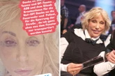 Weller-Witwe will sich für Interview zurechtmachen und bricht sich das Bein: "Dümmer geht es nicht"