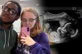 Eltern beobachten ungeborenes Kind beim Ultraschall: Was sich das Baby dann traut, verblüfft alle