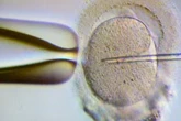 Samen-Sauerei: Arzt soll Müttern Fremdsperma gespritzt haben